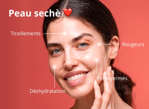 Peau sèche