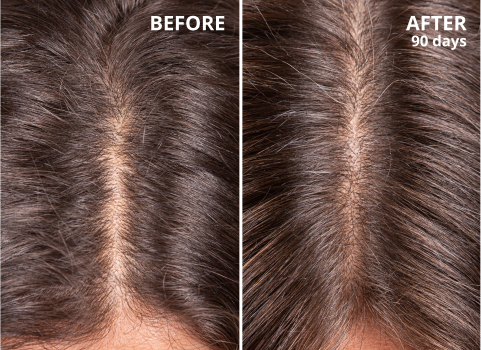 hair growth