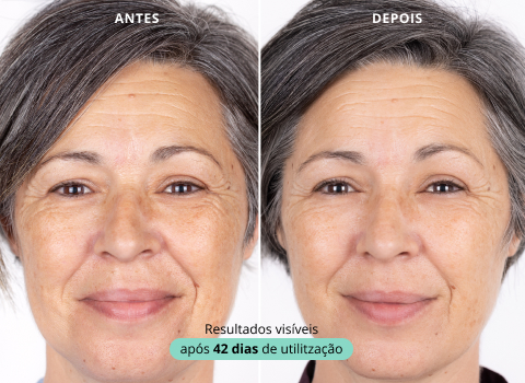 well ageing