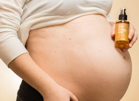 cambiar vértice Otros lugares Cómo prevenir y tratar las estrías del embarazo?