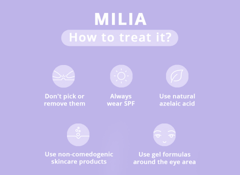 how to treat millia