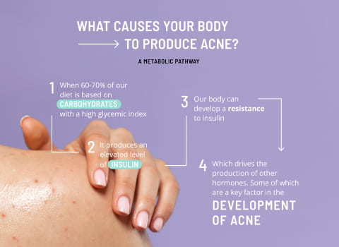 acne solutions