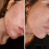 Red & Blue Serums Pack | Freshly Cosmetics