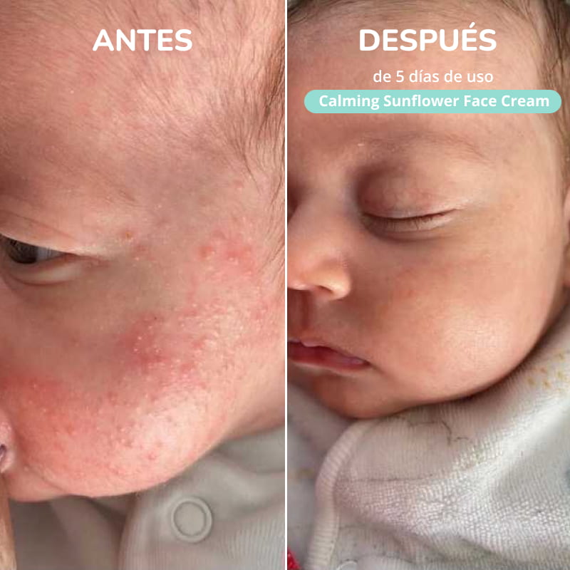Crema facial infantil 100% natural y saludable