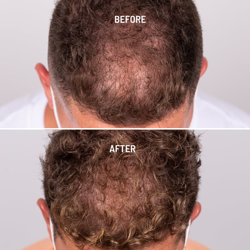 Growth deals hair treatment