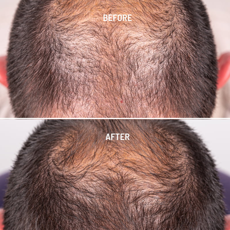 Growth cheap hair treatment