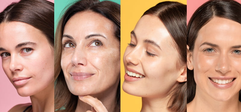6 tipos de piel: identifica la tuya y aprende a cuidarla