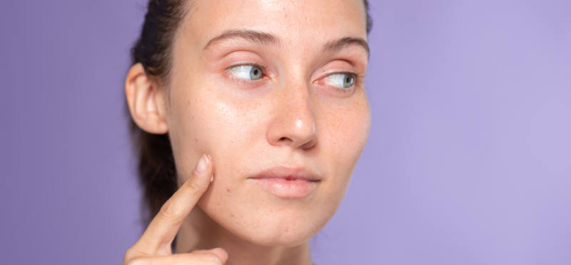 Descubre cómo tratar y prevenir el maskne de forma natural Descubre cómo tratar y prevenir el maskne de forma natural
