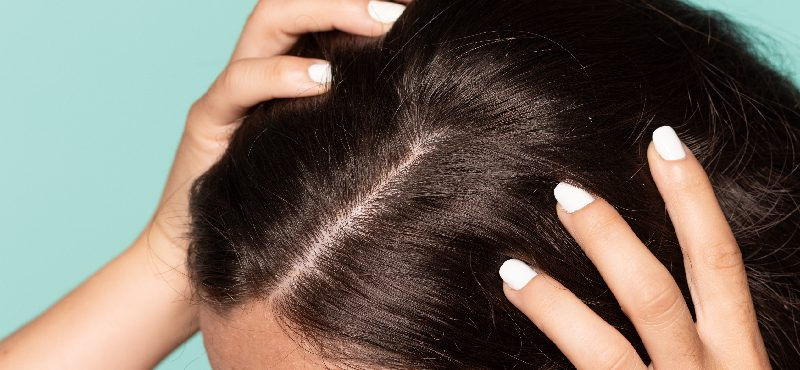 Dandruff, itching, irritation...? Discover scalp exfoliation and restore your hair